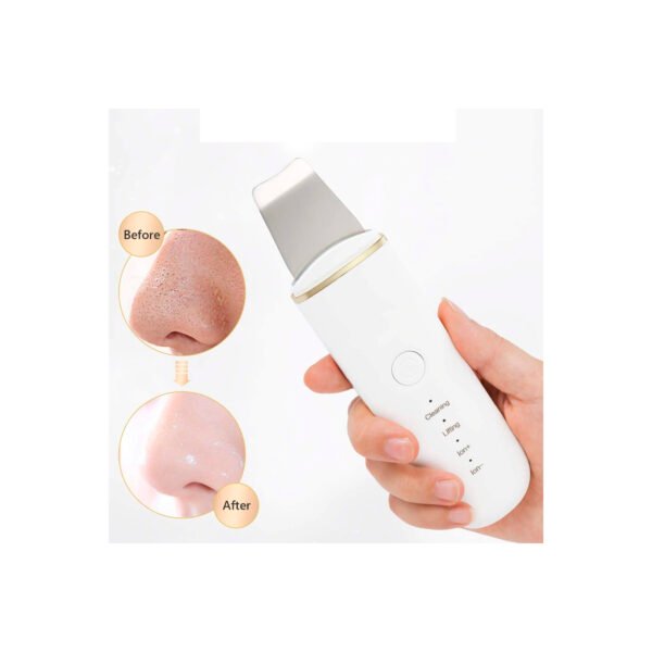 LIMPIADOR FACIAL ULTRASONICO - Imagen 4